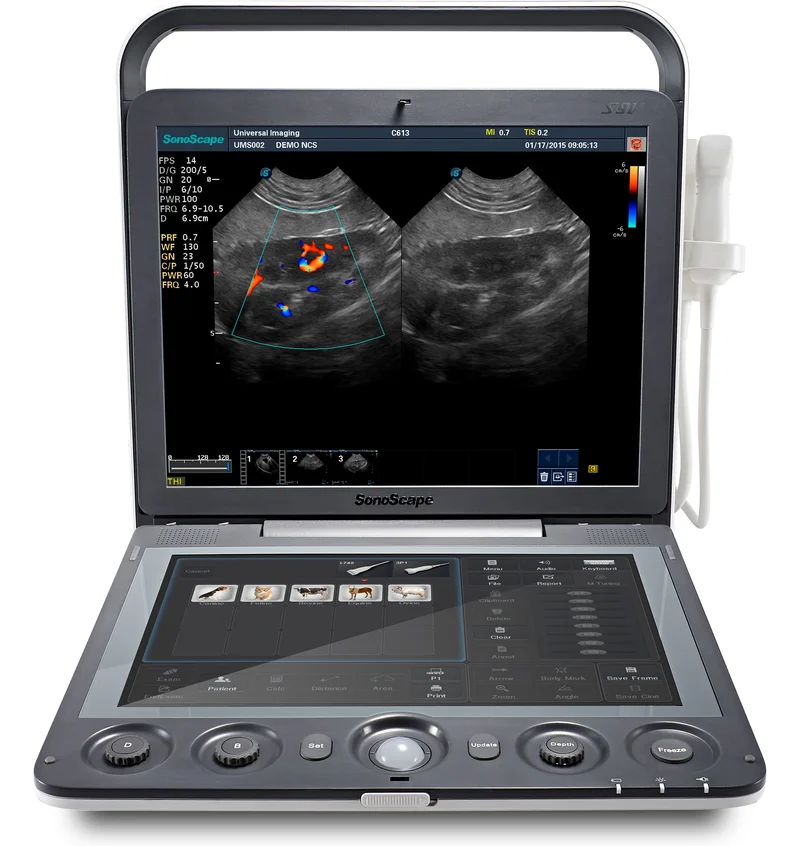 SonoScape S9V